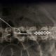 Image for article titled New Implant Helps Paralyzed Patients Regain Partial Use Of Their Legs